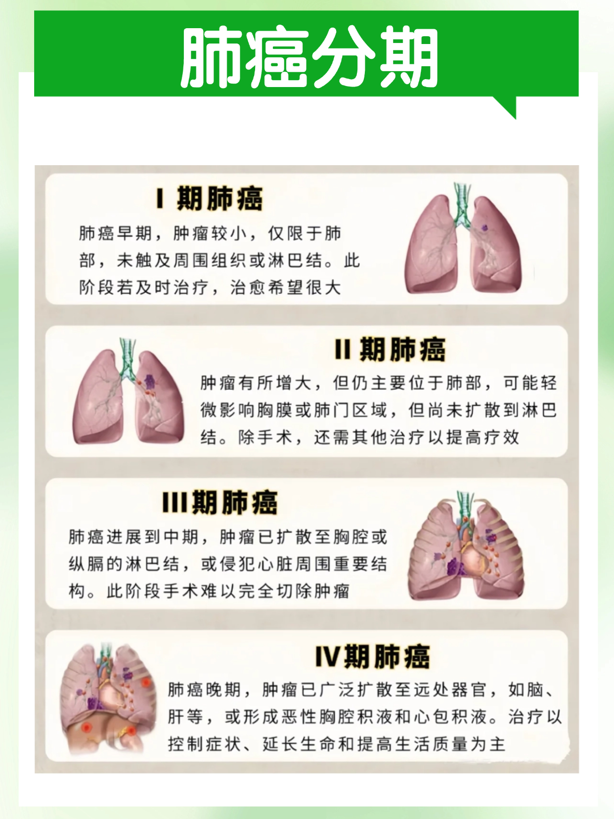 GFH375片-非小细胞肺癌KRAS G12D突变靶向药治疗新选择。